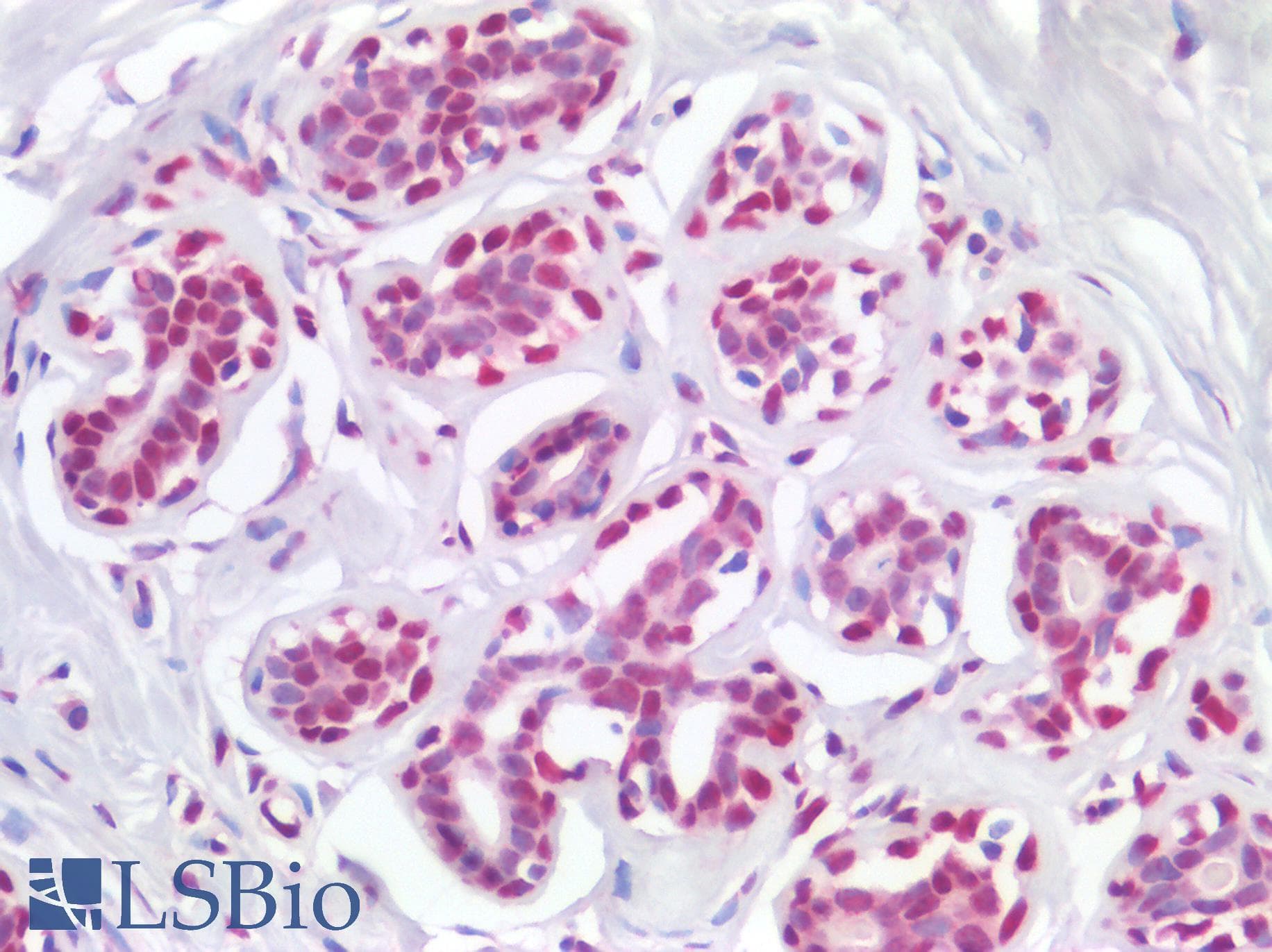 IHC-plus™ Polyclonal Rabbit anti-Human HMG1 / HMGB1 Antibody (IHC)
