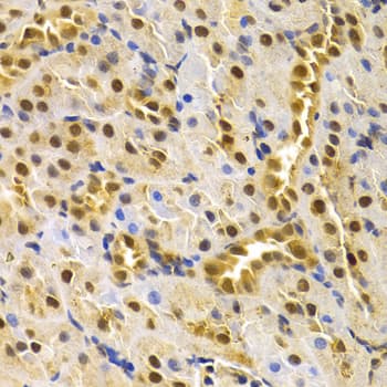 CDC25A Antibody