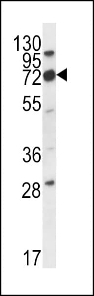 Polyclonal Rabbit anti-Human CD316 / IGSF8 Antibody (aa226-254, IHC, WB)