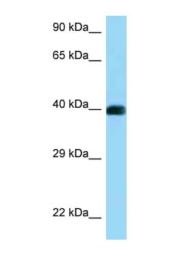 CD72 Antibody (aa273-322)
