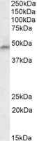 IHC-plus™ PH / PAH Antibody (aa66-76)
