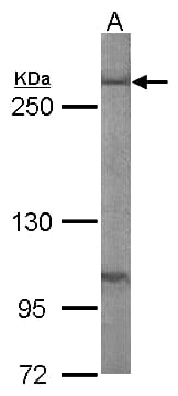 FASN / Fatty Acid Synthase Antibody (aa401-694)
