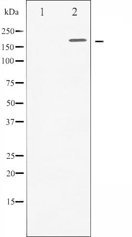 ERBB2 / HER2 Antibody