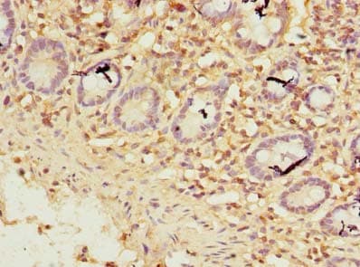 ZNF19 Antibody