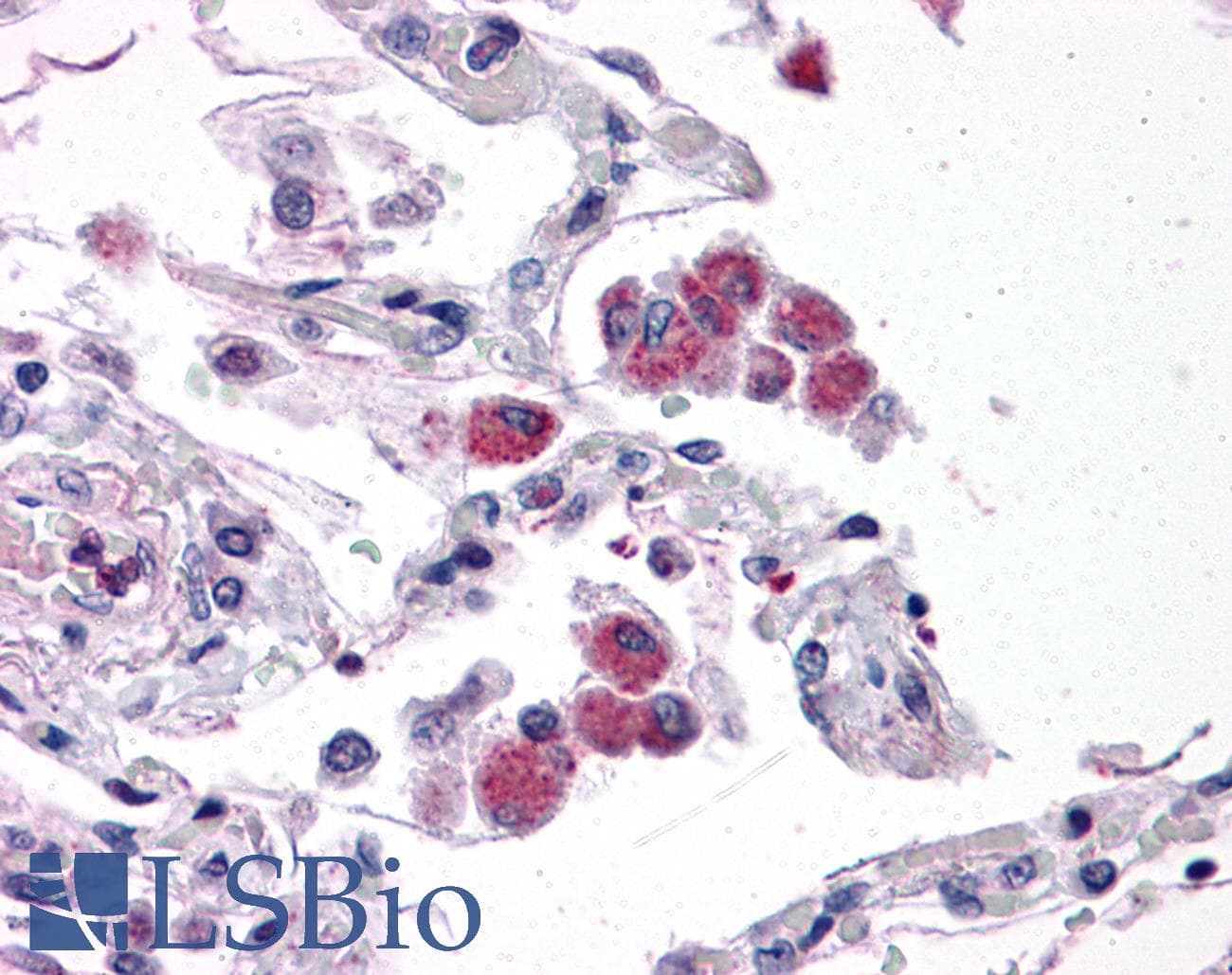 IHC-plus™ Polyclonal Rabbit anti-Human GAREML Antibody (IHC, IF, WB)