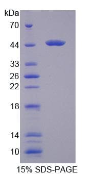 Human HSPA6 / HSP70B' Protein (Recombinant His-T7)