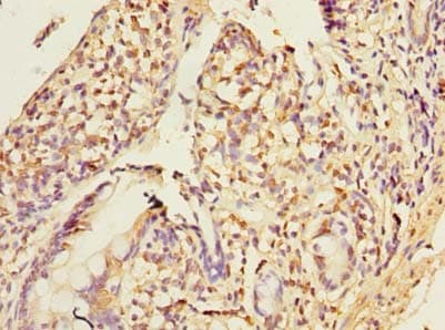 PLA2G16 / HRASLS3 Antibody