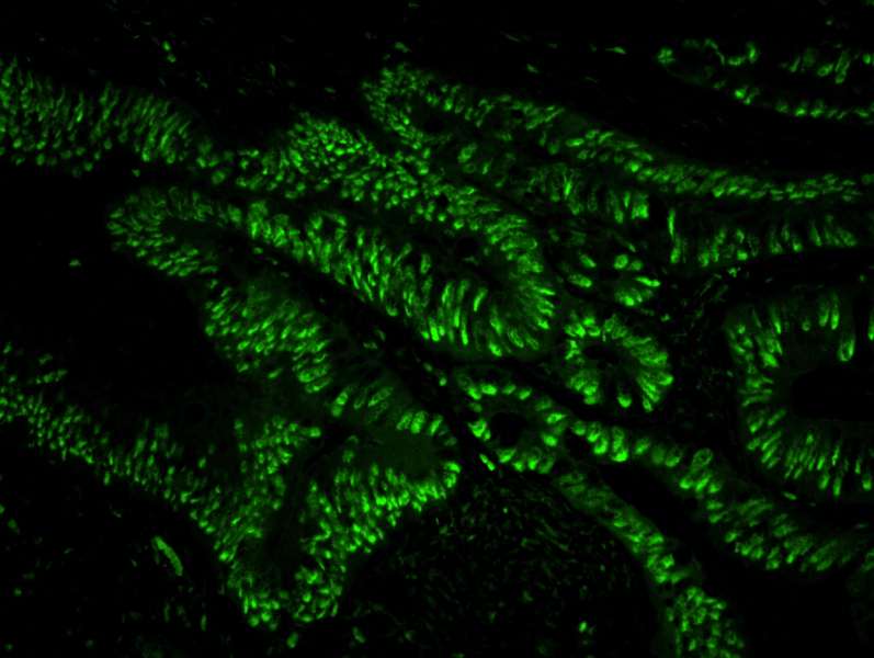 IHC-plus™ Polyclonal Rabbit anti-Human USP7 / HAUSP Antibody (aa1-50, IHC, IF)