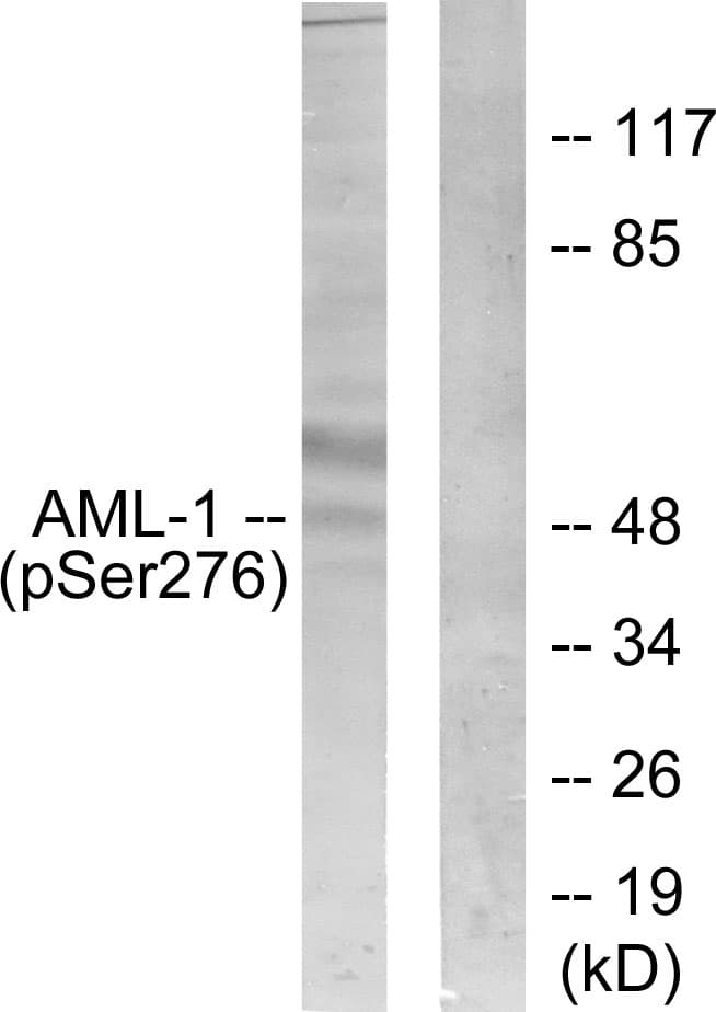 Polyclonal Rabbit anti-Human AML1 / RUNX1 Antibody (phospho-Ser276, WB)