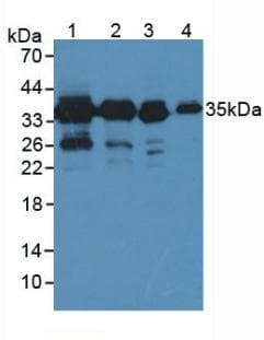 PDXK / PNK Antibody (aa29-285)