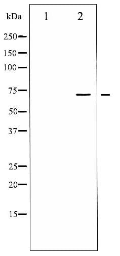 LIMK1 + LIMK2 Antibody (phospho-Thr508/505)