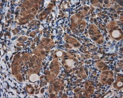 TLDC1 / KIAA1609 Antibody (clone OTI3C4, Carrier-free)