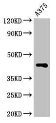 Polyclonal Rabbit anti-Human AURKC / Aurora C Antibody (IHC, IF, WB)