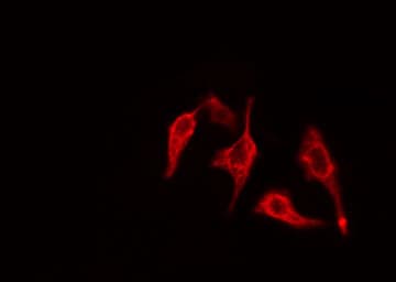Polyclonal Rabbit anti-Human RAB3GAP1 Antibody (IHC, IF, WB)