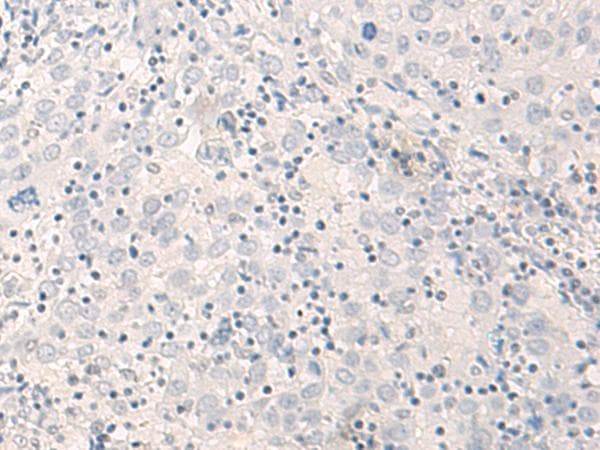 Polyclonal Rabbit anti-Human THOP1 / Thimet Oligopeptidase Antibody (IHC, WB)