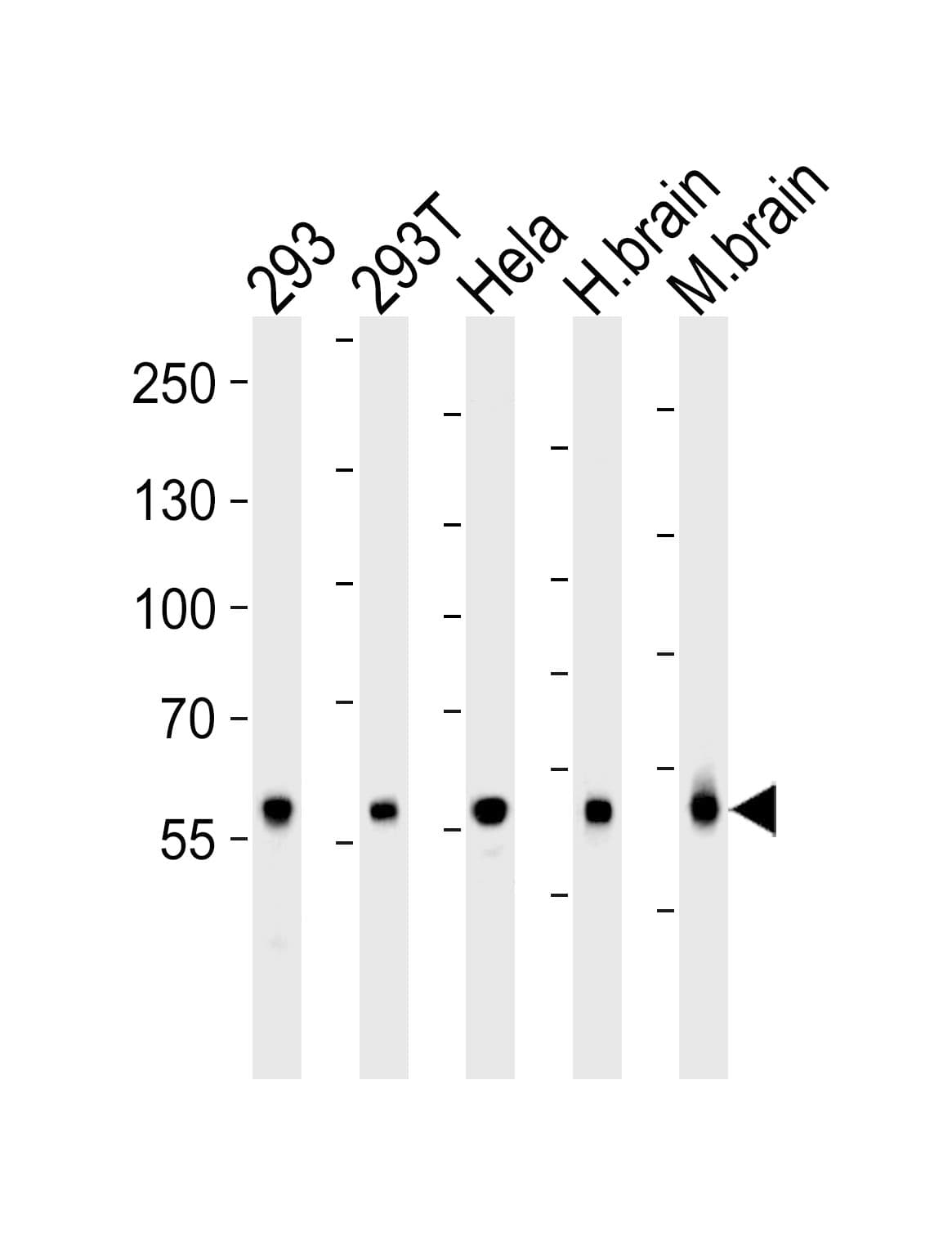 GLS / Glutaminase Antibody (aa516-545)
