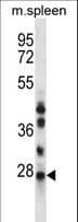 NQO2 Antibody (aa51-79)