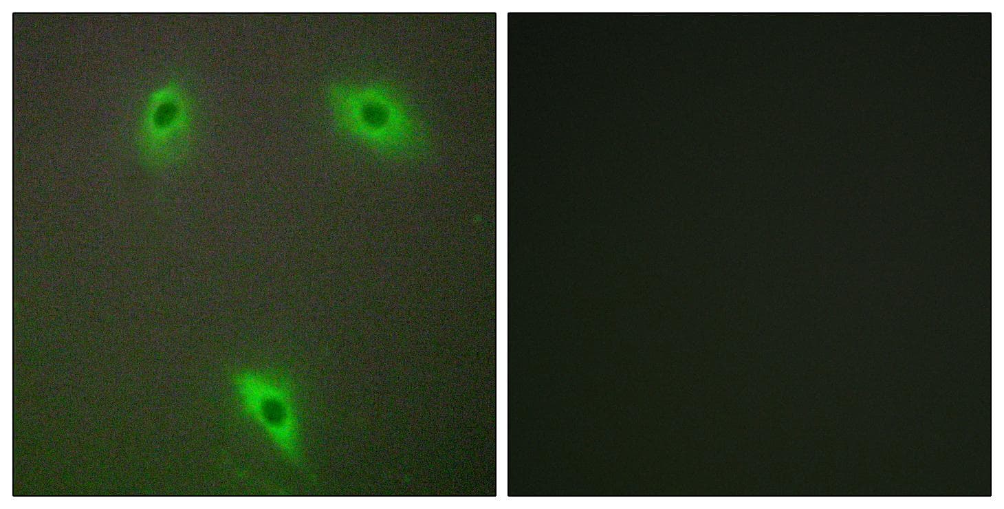 Polyclonal Rabbit anti-Human KLHL3 Antibody (IHC, IF, WB)