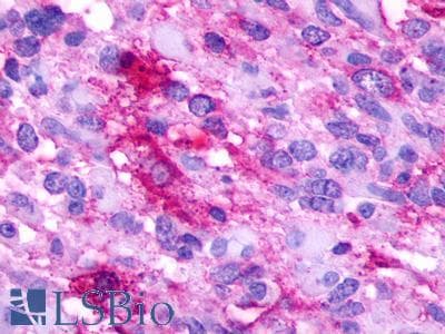PathPlus™ GPR35 Antibody (Cytoplasmic Domain)