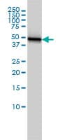 KRT18 / CK18 / Cytokeratin 18 Antibody (clone 2F8)