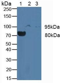 CSF3R / CD114 Antibody (aa26-138)