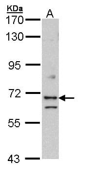 Polyclonal Rabbit anti-Human EXOC7 Antibody (aa74-335, WB)