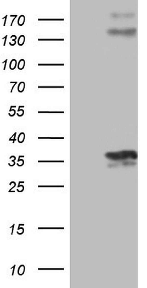 PROCR / EPCR Antibody (aa1-210, clone OTI9E11)