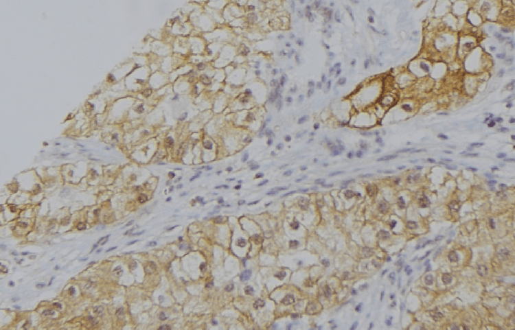 Properdin / CFP Antibody
