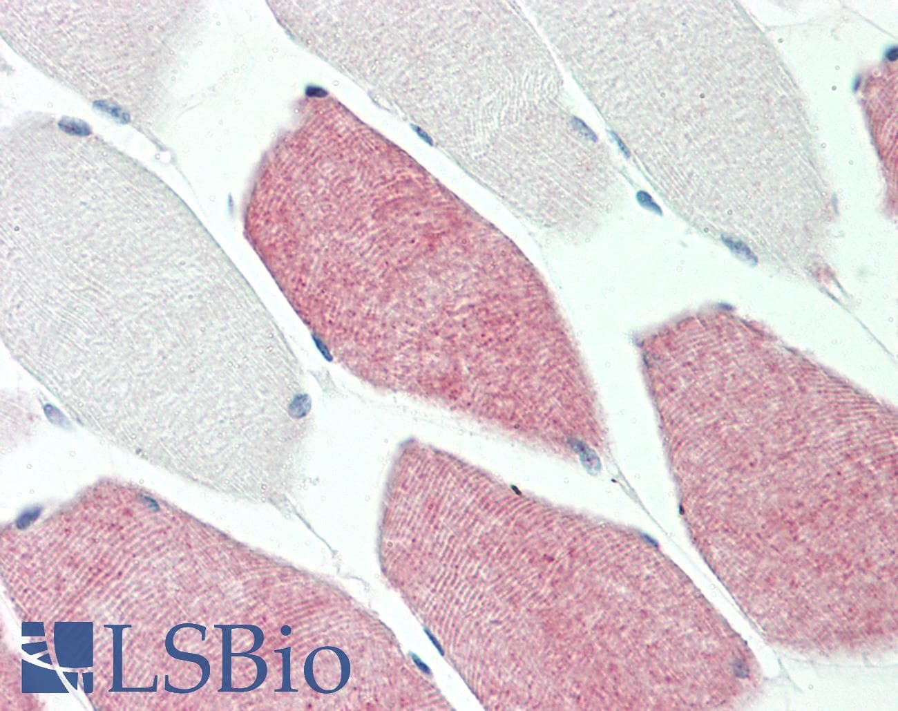IHC-plus™ Polyclonal Rabbit anti-Human SMAD2 Antibody (aa418-467, IHC, IF, WB)