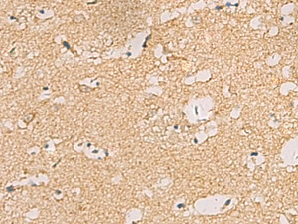 CNST Antibody