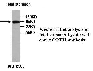 Polyclonal Rabbit anti-Human ACOT11 / THEA Antibody (Internal, IHC, WB)