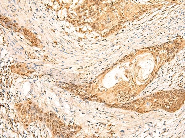 Polyclonal Rabbit anti-Human METTL10 Antibody (IHC)