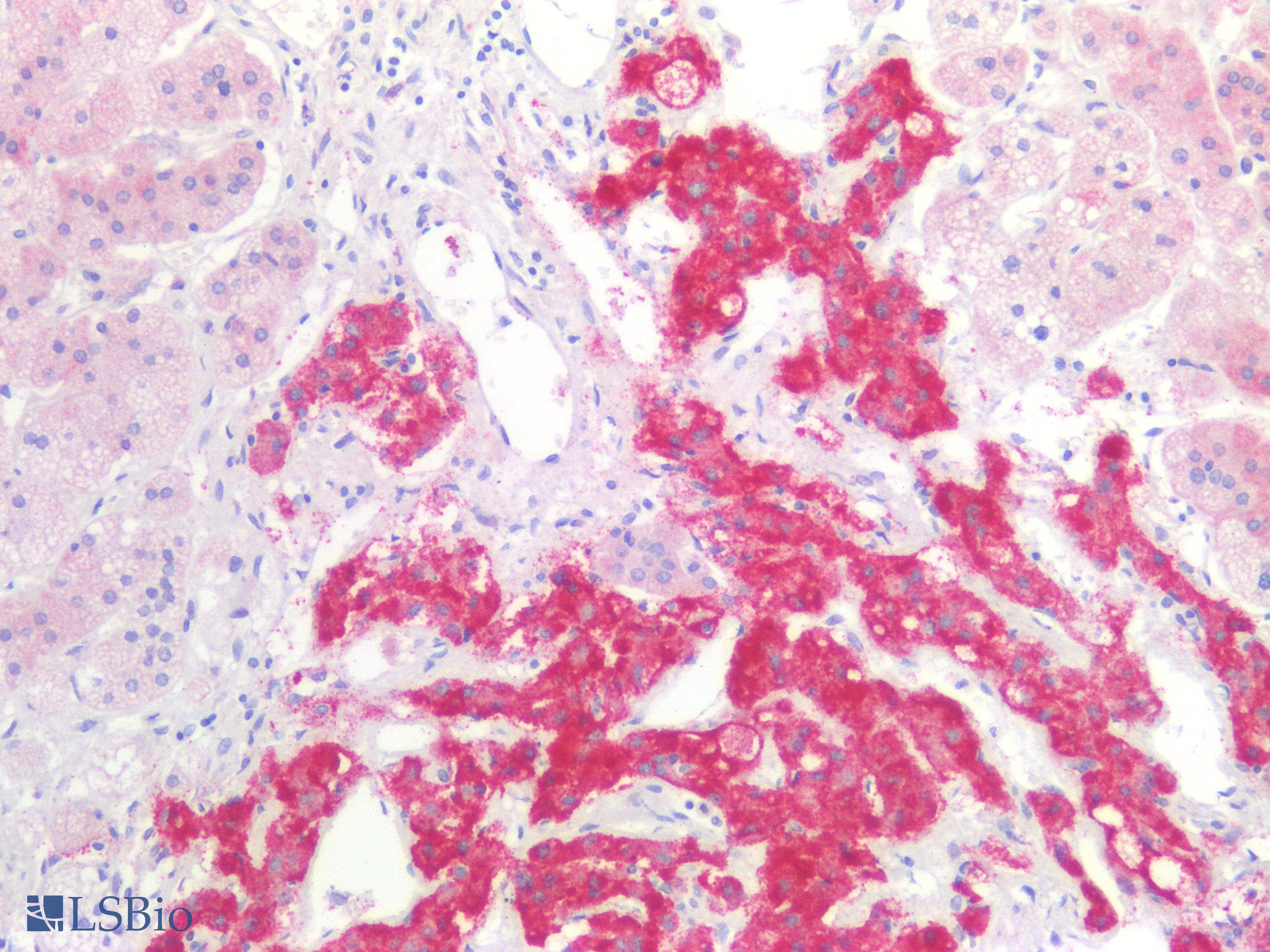 PathPlus™ HSD17B12 Antibody
