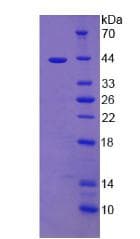 Human CCK / Cholecystokinin Protein (Recombinant His-GST)