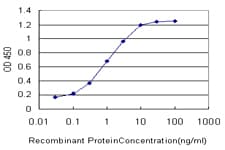 GRM7 / MGLUR7 Antibody (clone 1H5)