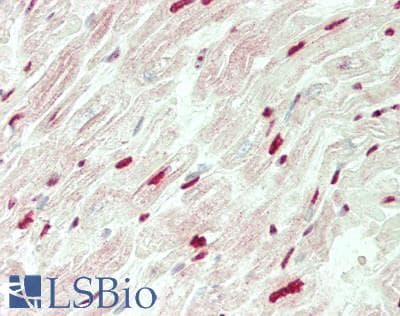 IHC-plus™ Polyclonal Rabbit anti-Human ST18 Antibody (aa23-72, IHC, WB)