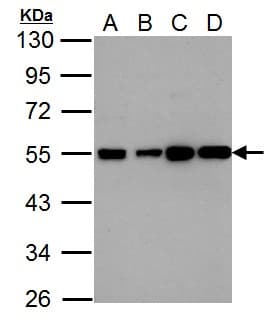 Polyclonal Rabbit anti-Human HRH2 / Histamine H2 Receptor Antibody (aa1-45, IHC, WB)