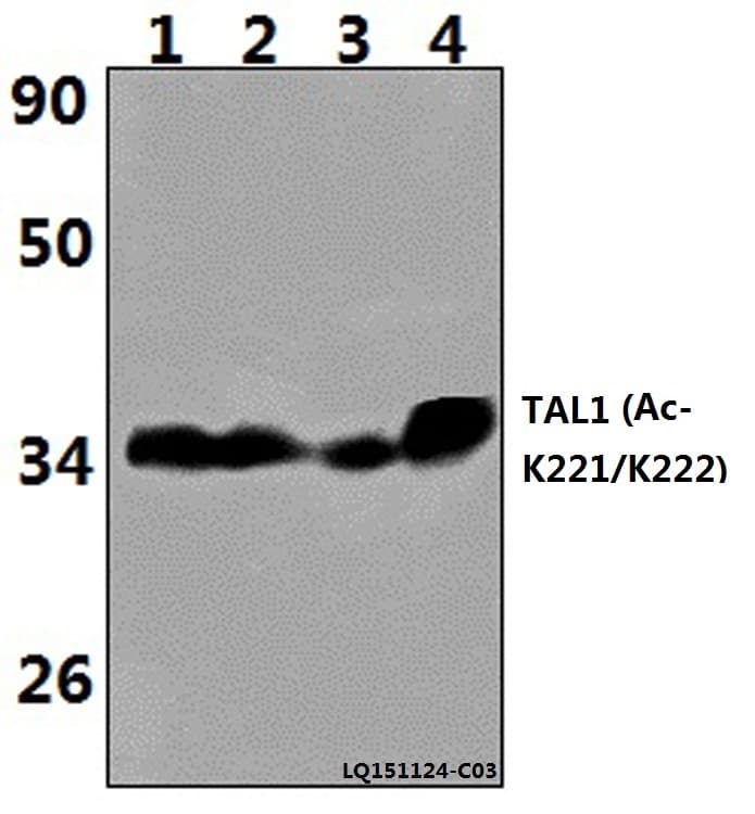 TAL1 Antibody (Acetyl-Lys221/222)