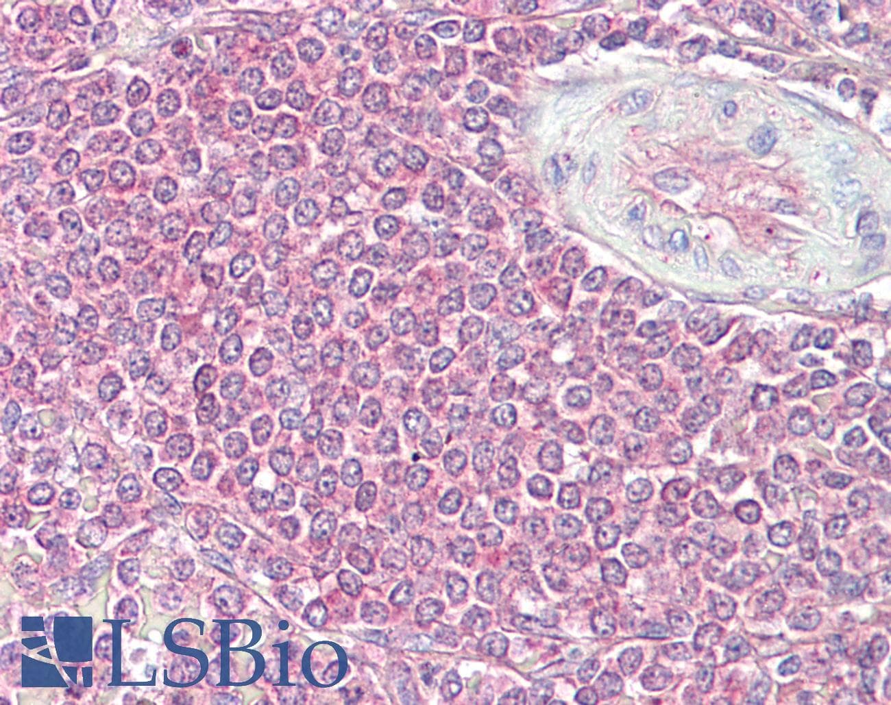 IHC-plus™ MAP2K3 / MEK3 / MKK3 Antibody (aa173-222)