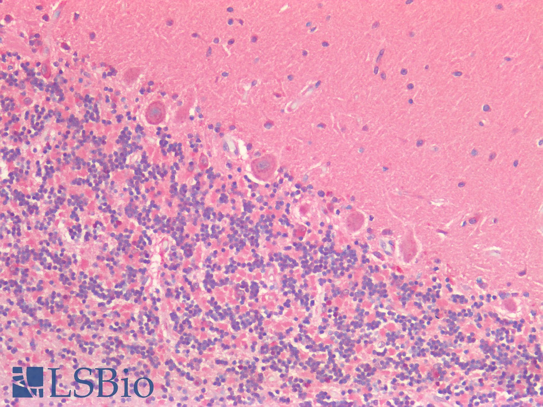 IHC-plus™ EPHB2 / EPH Receptor B2 Antibody (C-Terminus)
