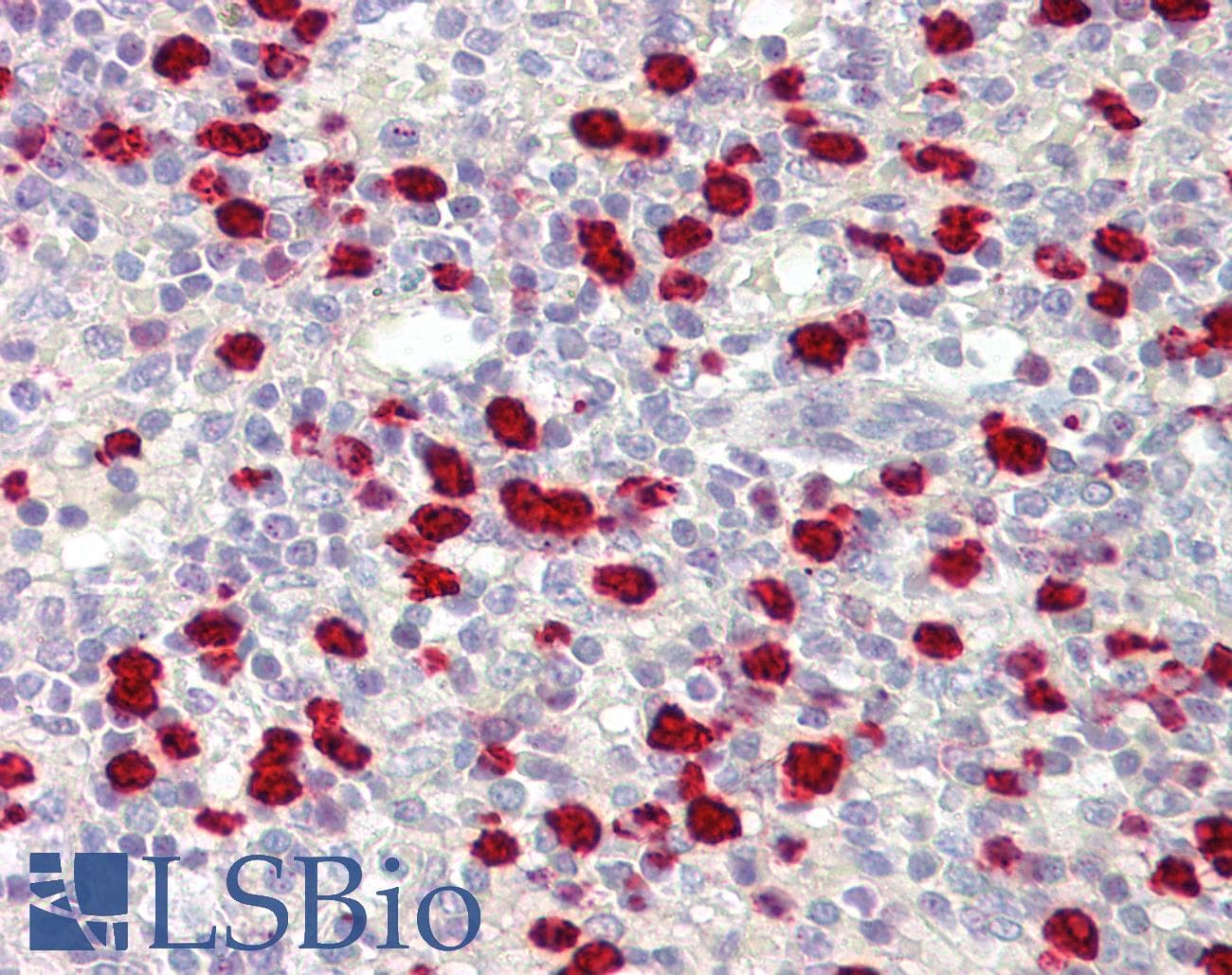 ZNF746 / PARIS Antibody (aa395-444, HRP)