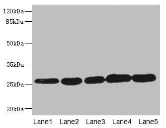 GSTK1 Antibody