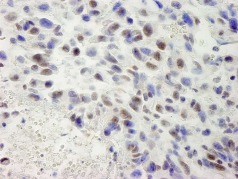 SETD1A / SET1 Antibody (aa1200-1250)