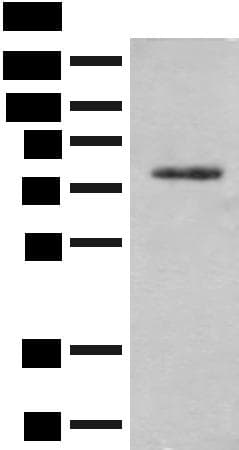 TRMT1 Antibody