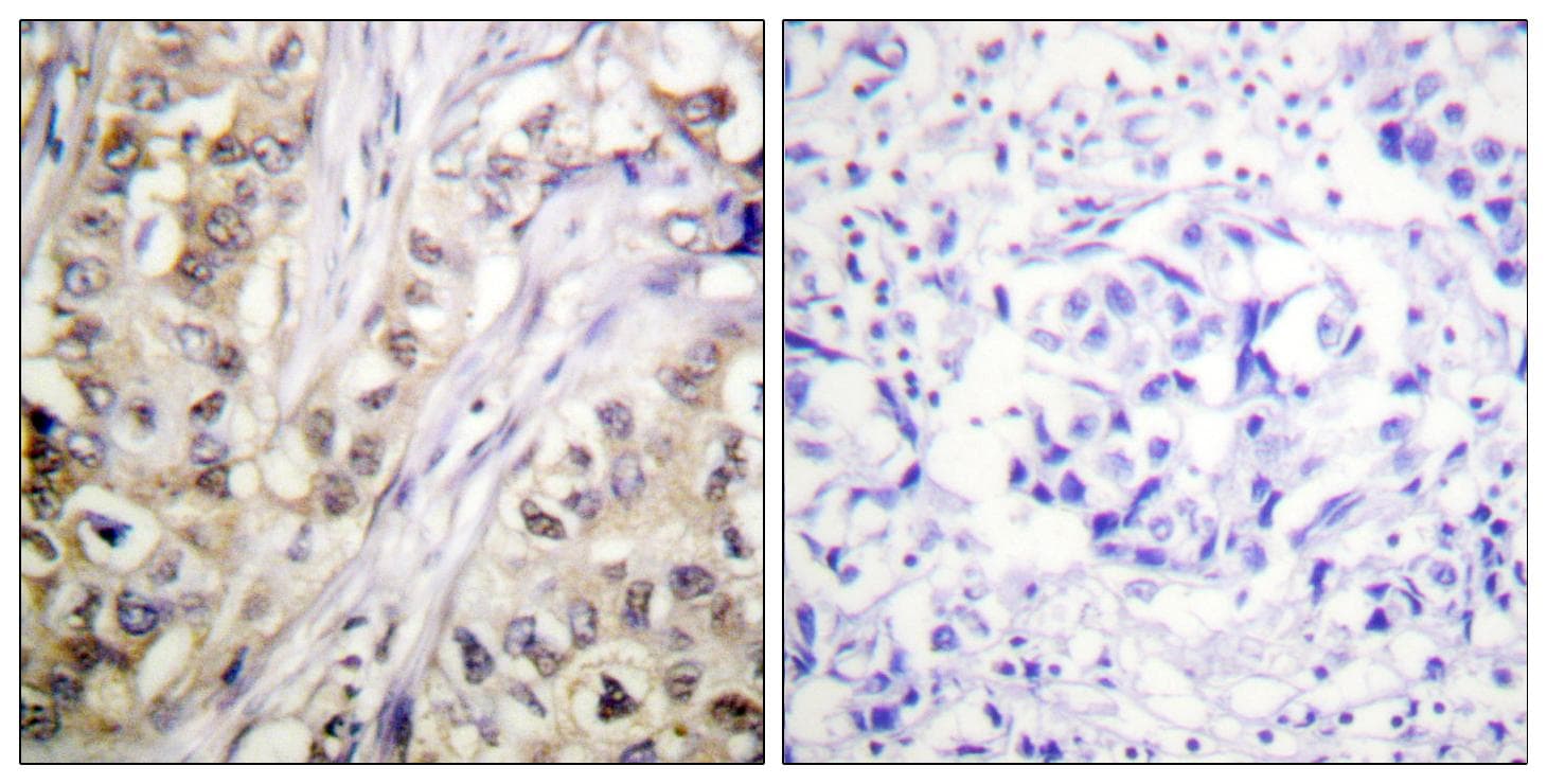 Polyclonal Rabbit anti-Human BIRC5 / Survivin Antibody (p117, IHC, IF, WB)