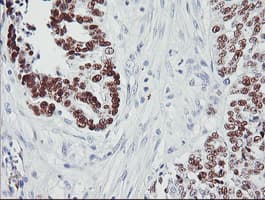 TP53 / p53 Antibody (clone OTI1D8)
