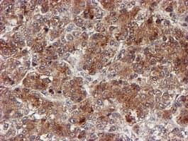 CYP17 / CYP17A1 Antibody (clone OTI3F11)