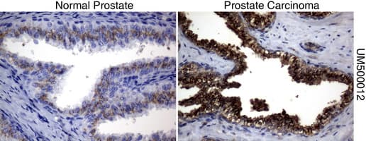 Monoclonal Mouse anti-Human SQSTM1 Antibody (clone UMAB12, Carrier-free, IHC, IF, WB)