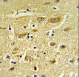 IHC-plus™ HIAT1 Antibody (aa454-483)