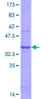 Human PARP2 Protein (Recombinant GST, N-terminus)